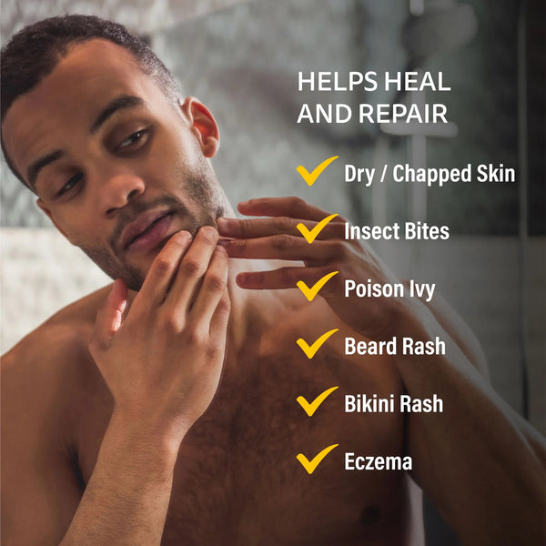 Medicated Rash Ointment Relieves Rash & Skin Irritated Skin - 1 pack - 1.5 oz per pack - plus 3 My Outlet Mall Resealable Storage Pouches